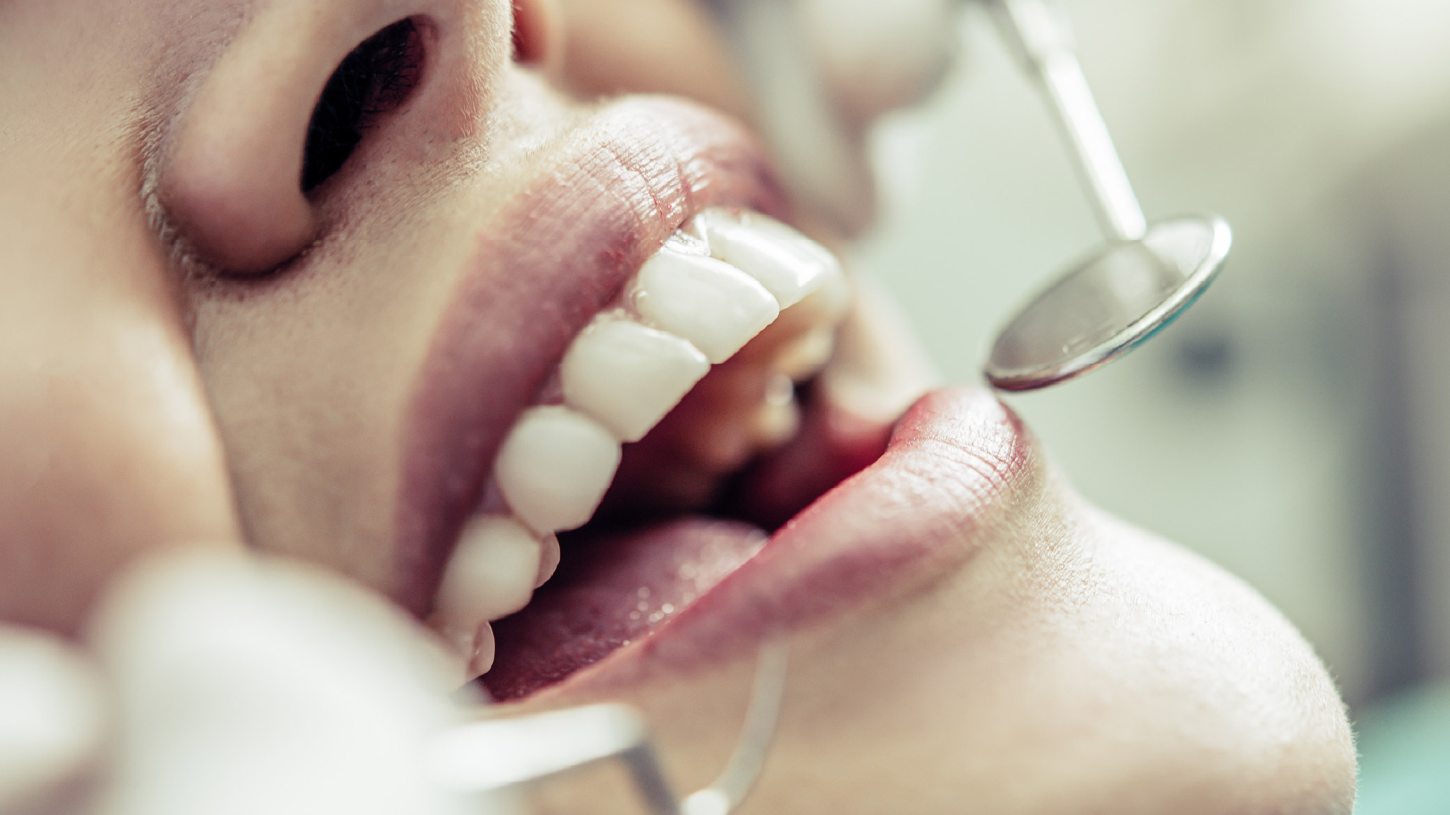 عيادة د. محمد عليان لطب وتقويم الأسنان 