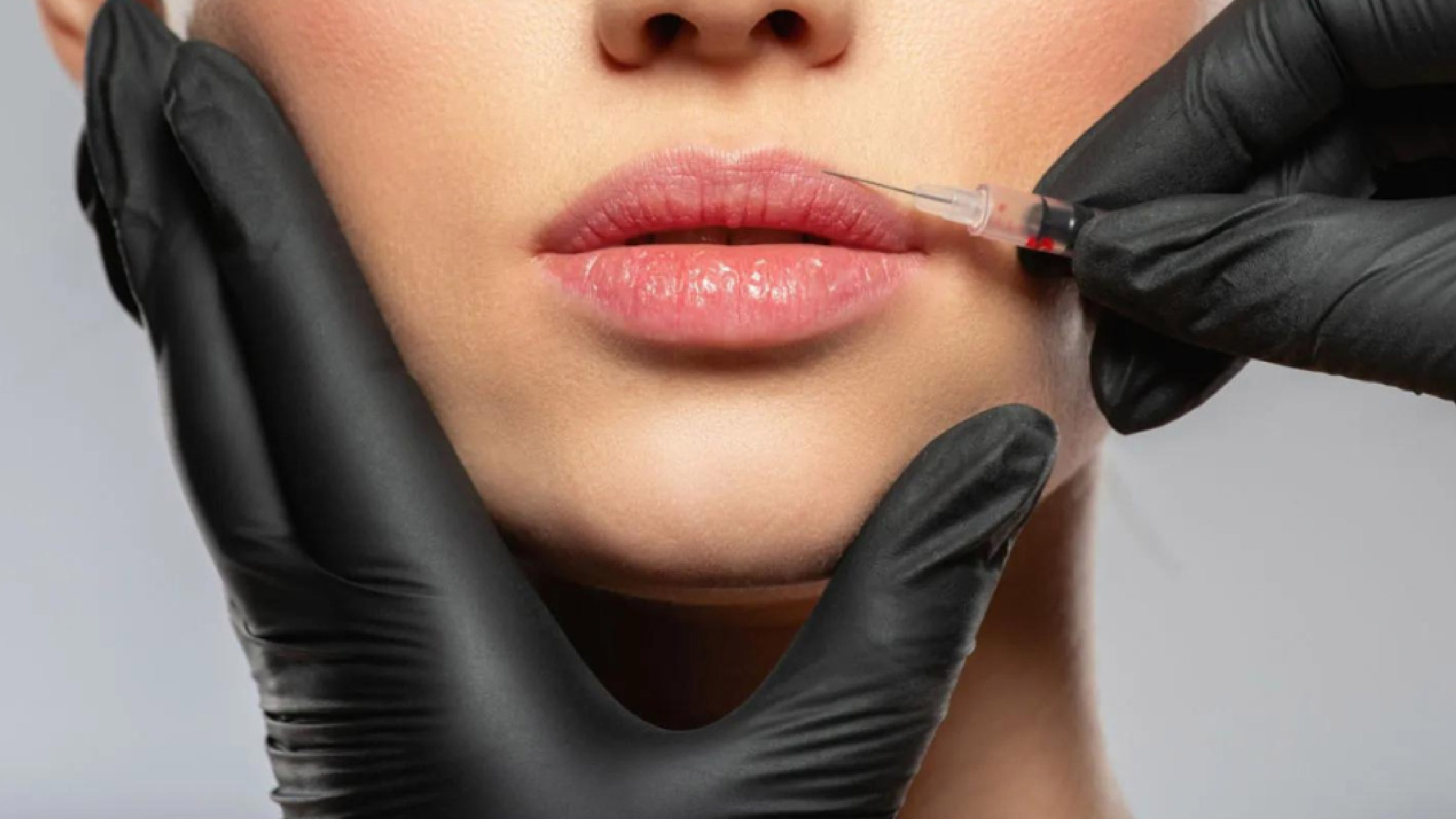 Dr husniah aesthetic