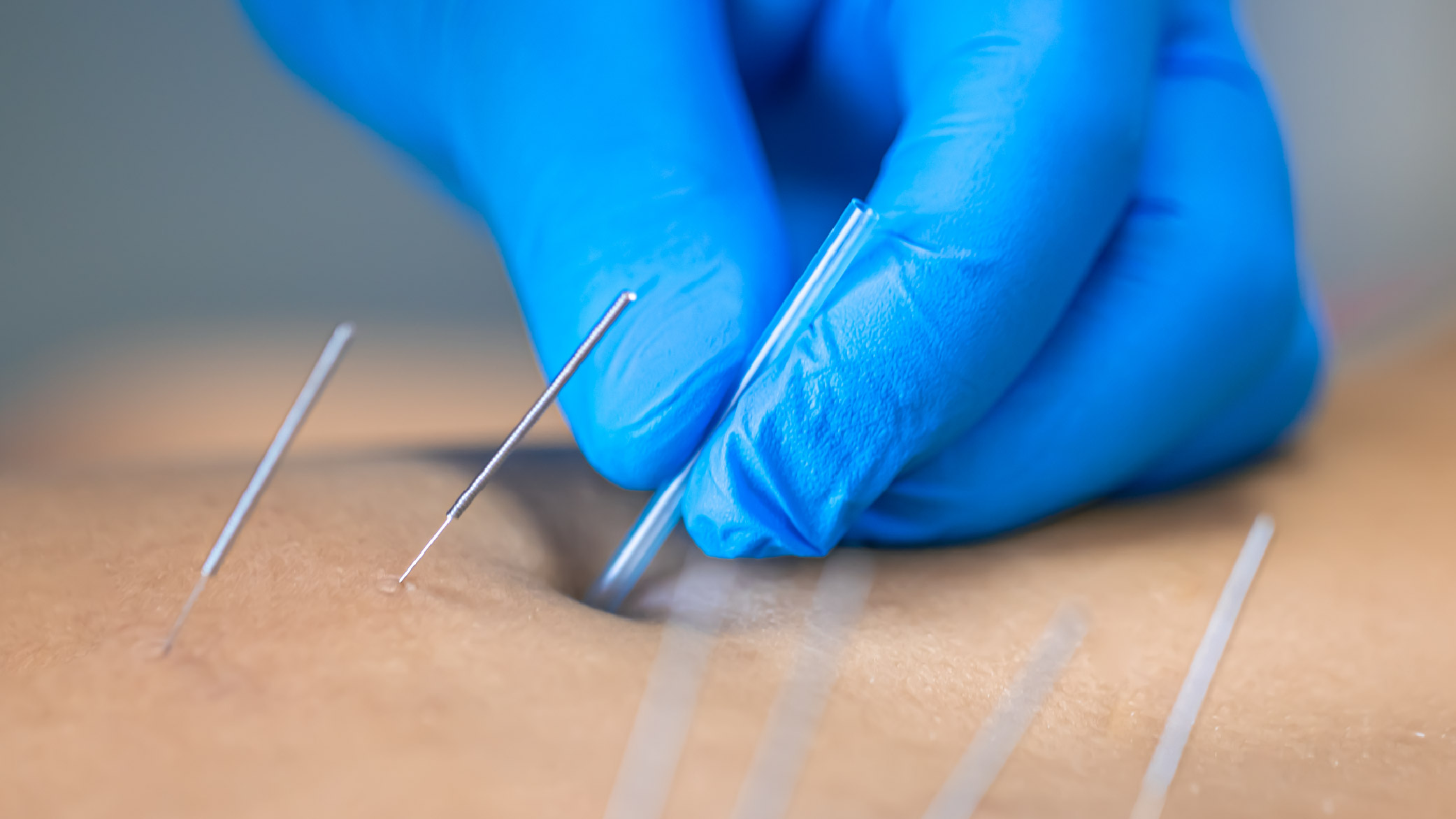 משה אגמי רפואה אלטרנטיבית