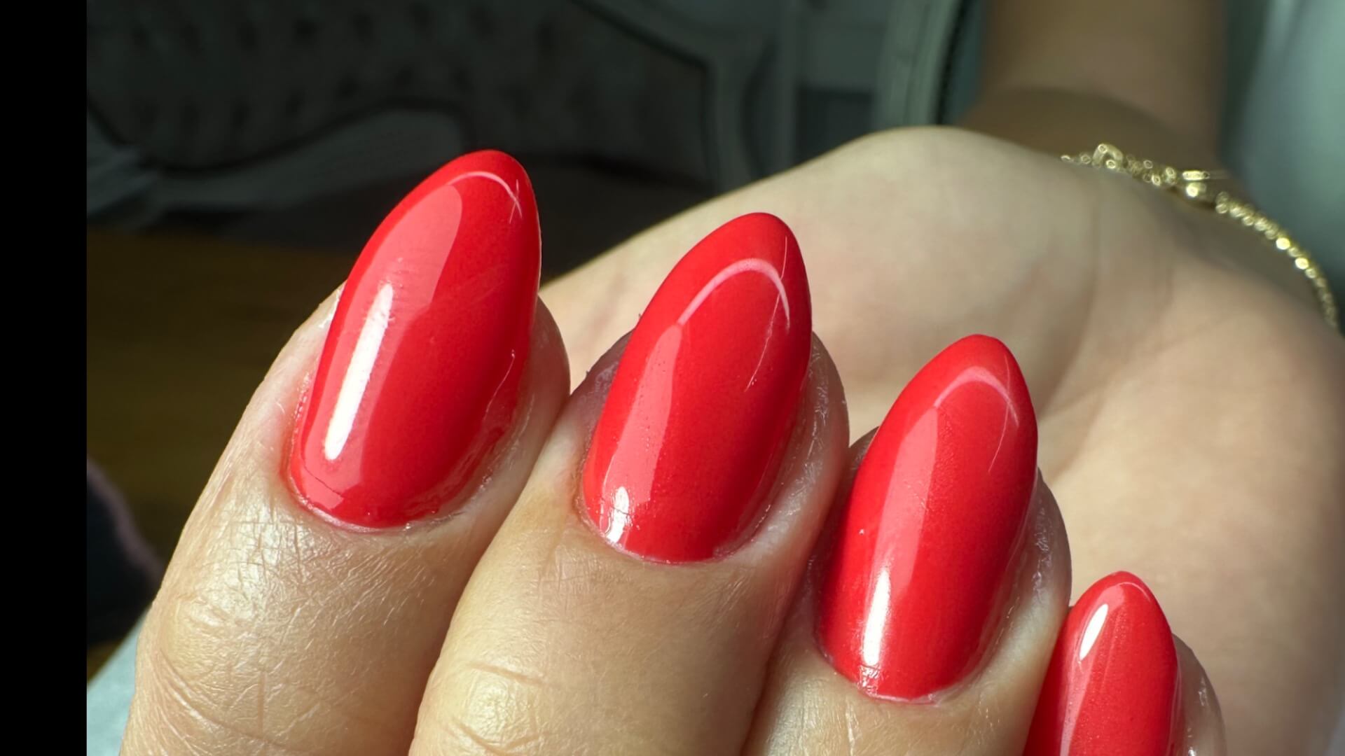 ציפורניים ולייזר