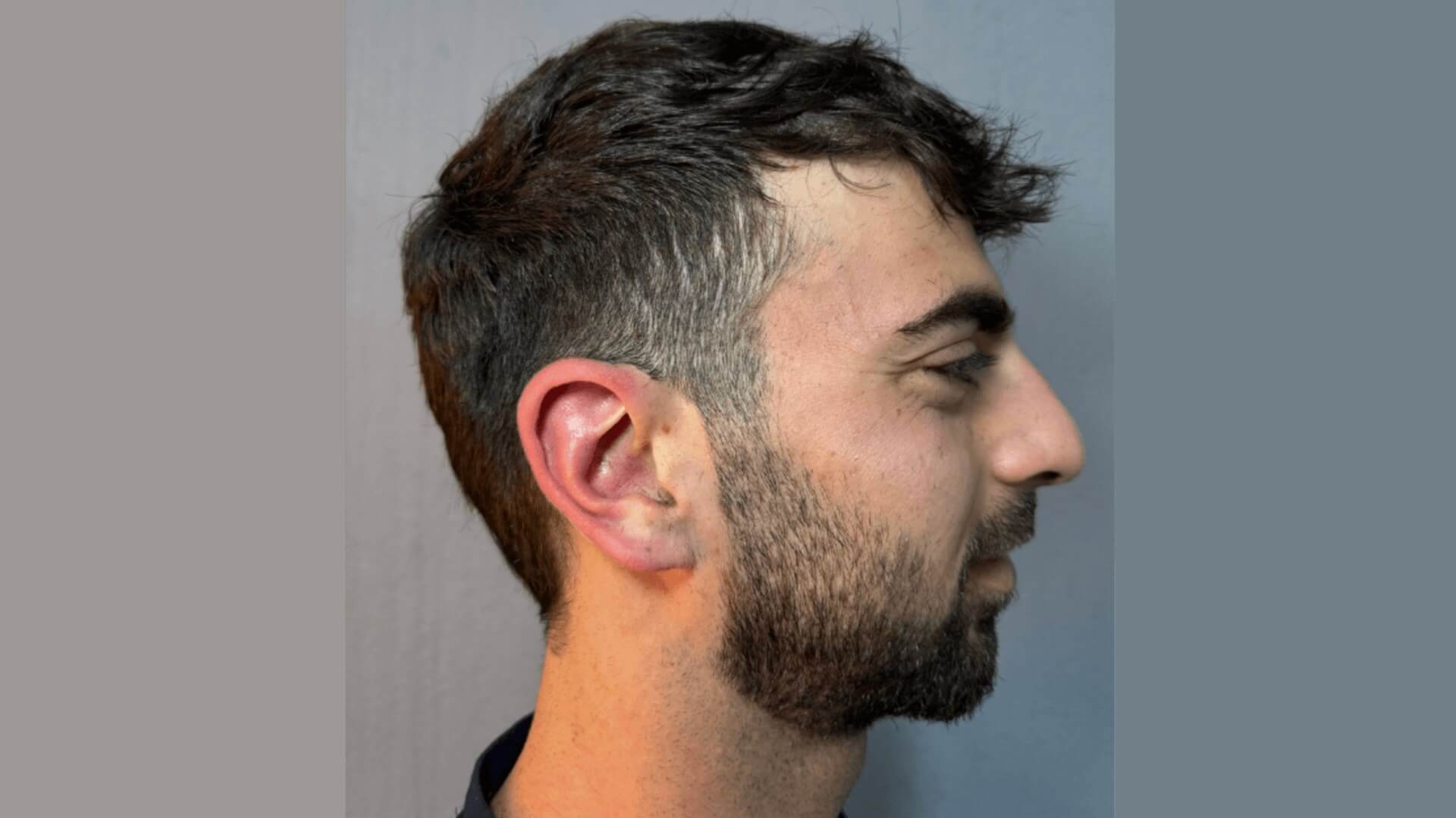 צברבר
