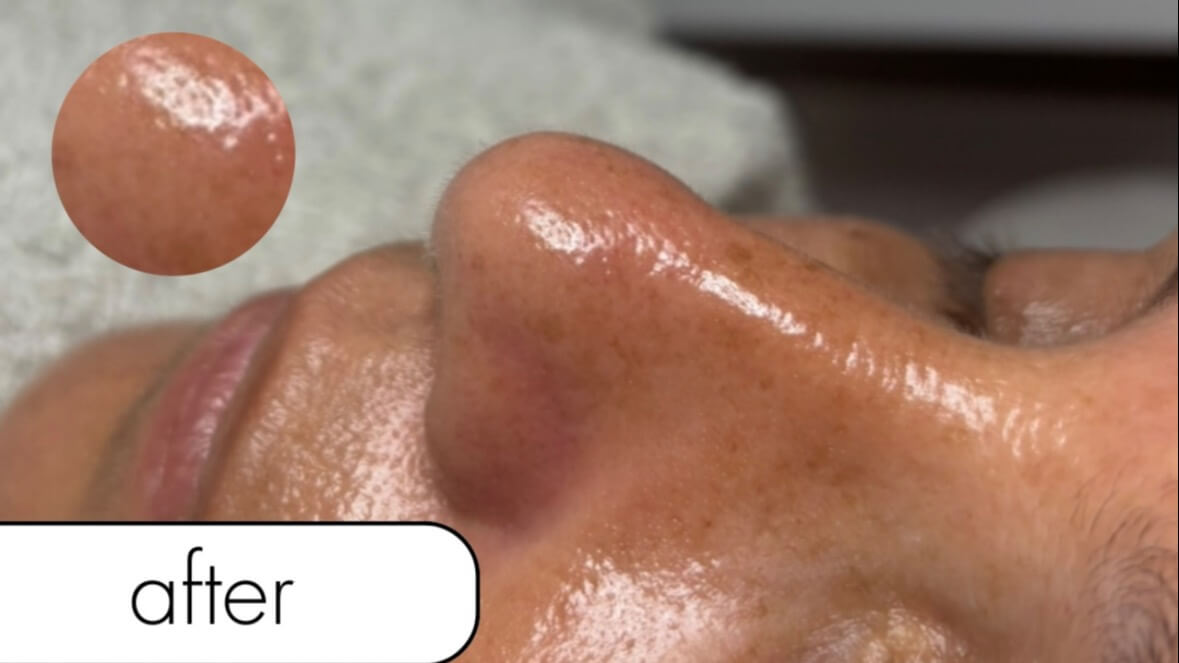 נופר קוסמטיקאית