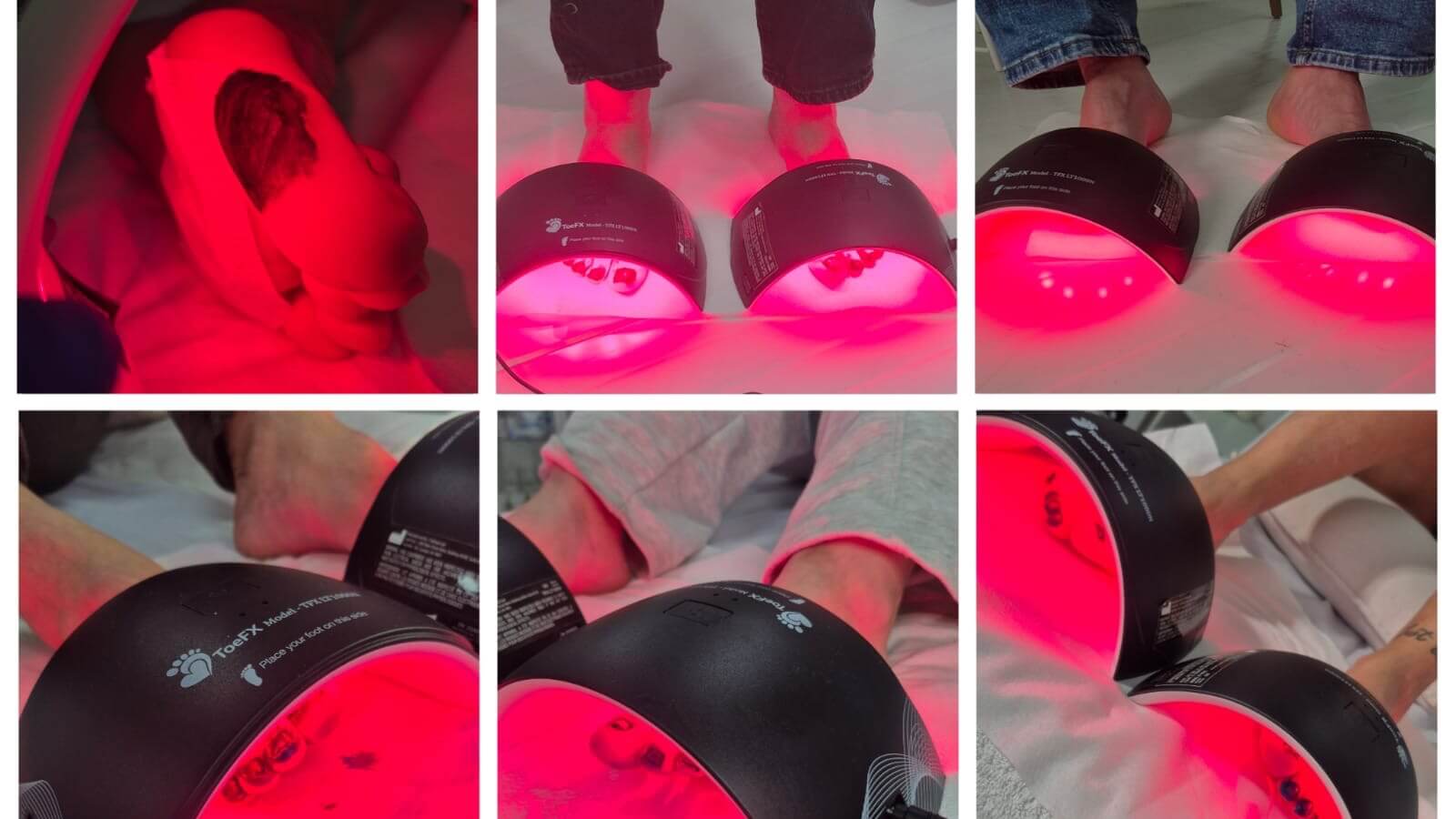 אורטל דיין פדיקור טיפולי שיקומי