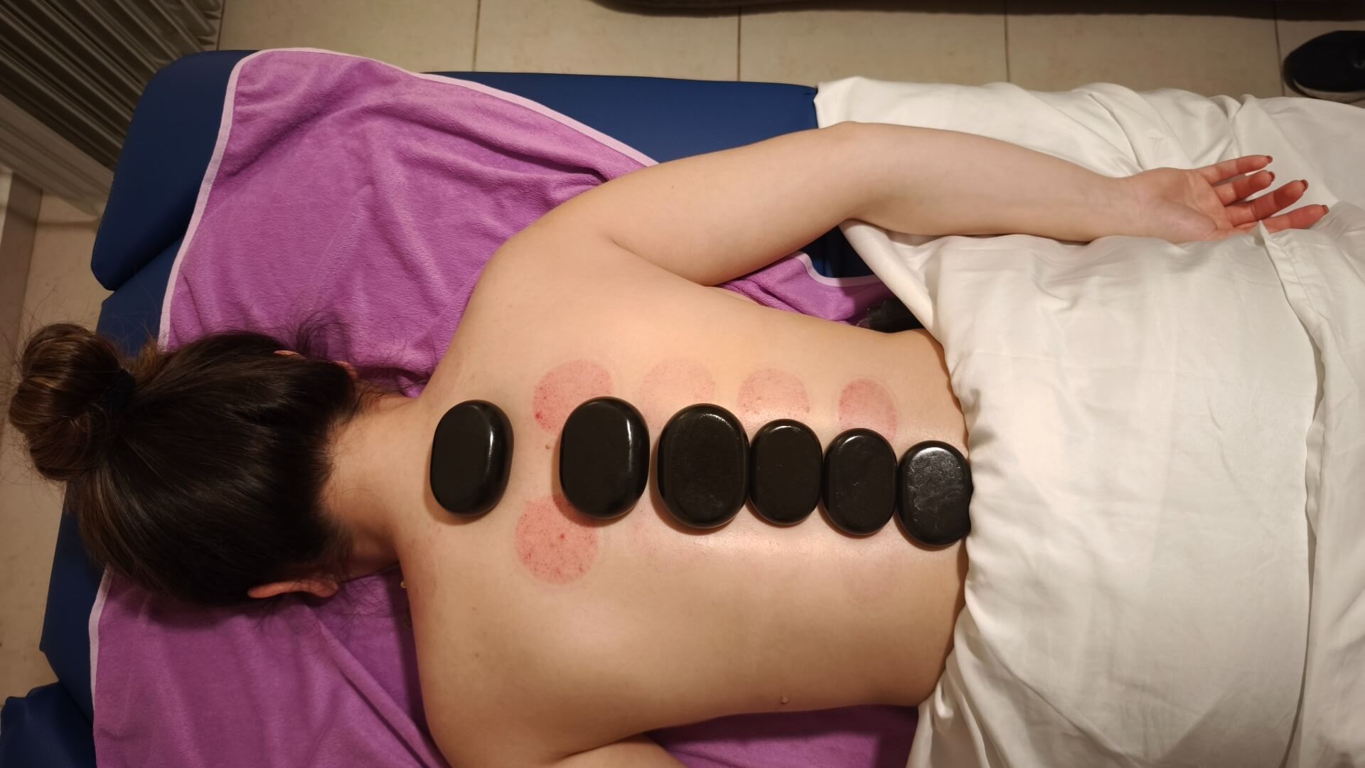  | ראובן מנדלר -עיסוי ורפלקסולוגיה