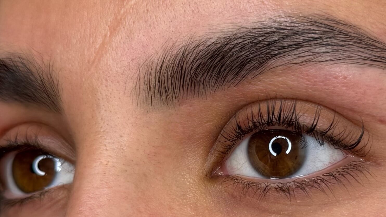  | KB Eyebrow