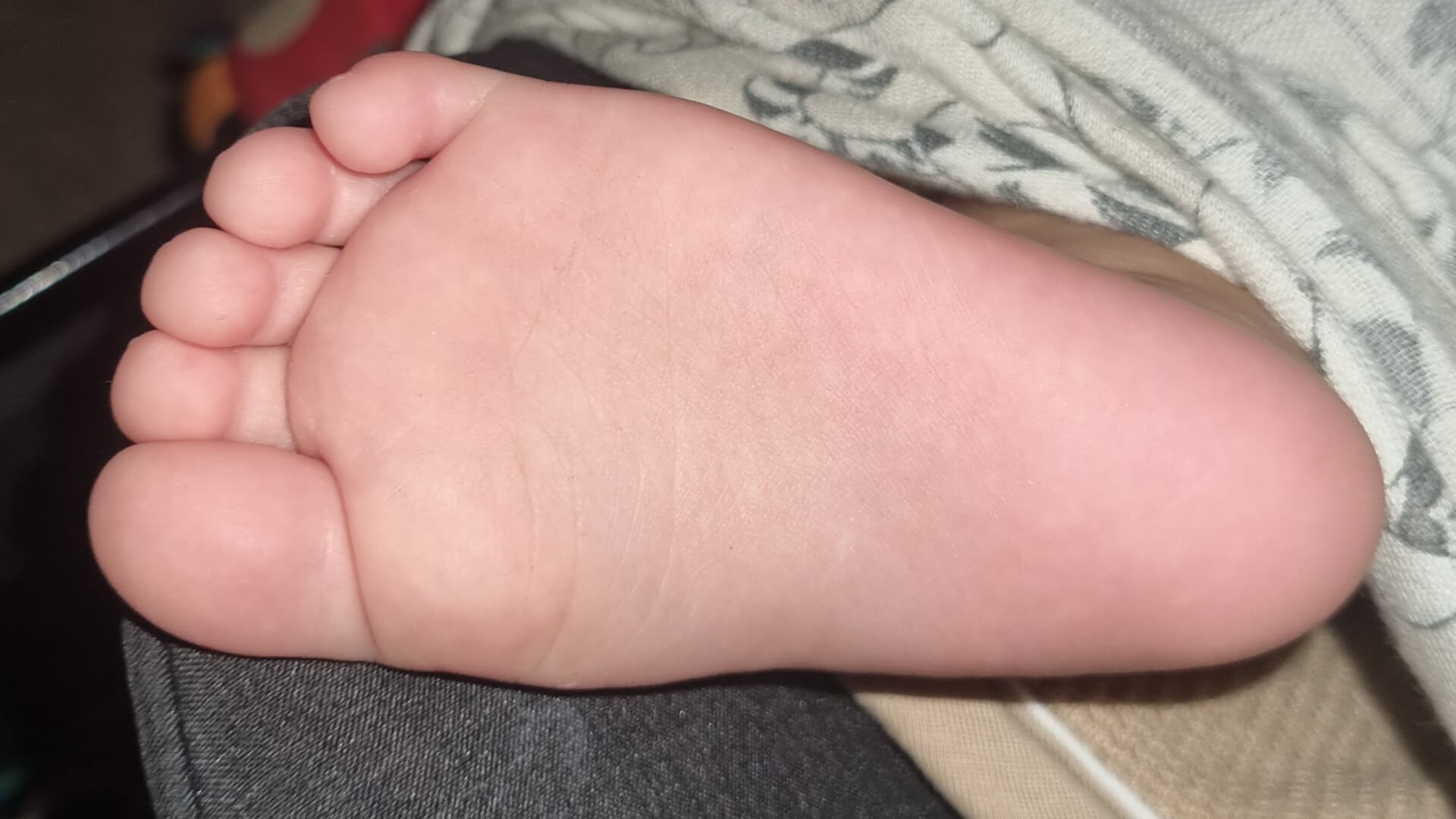 יוסי רפלקסולוגיה