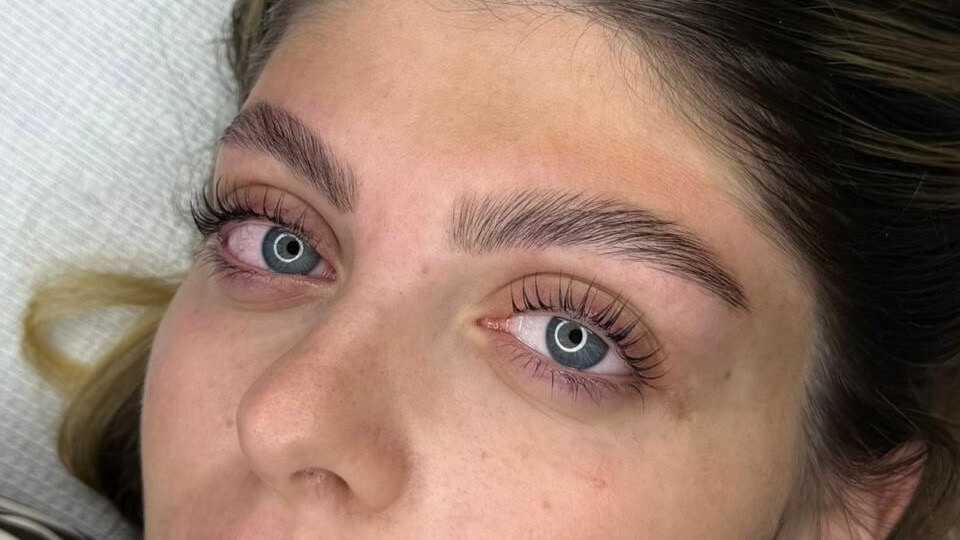 אנט פרידליאנסקי