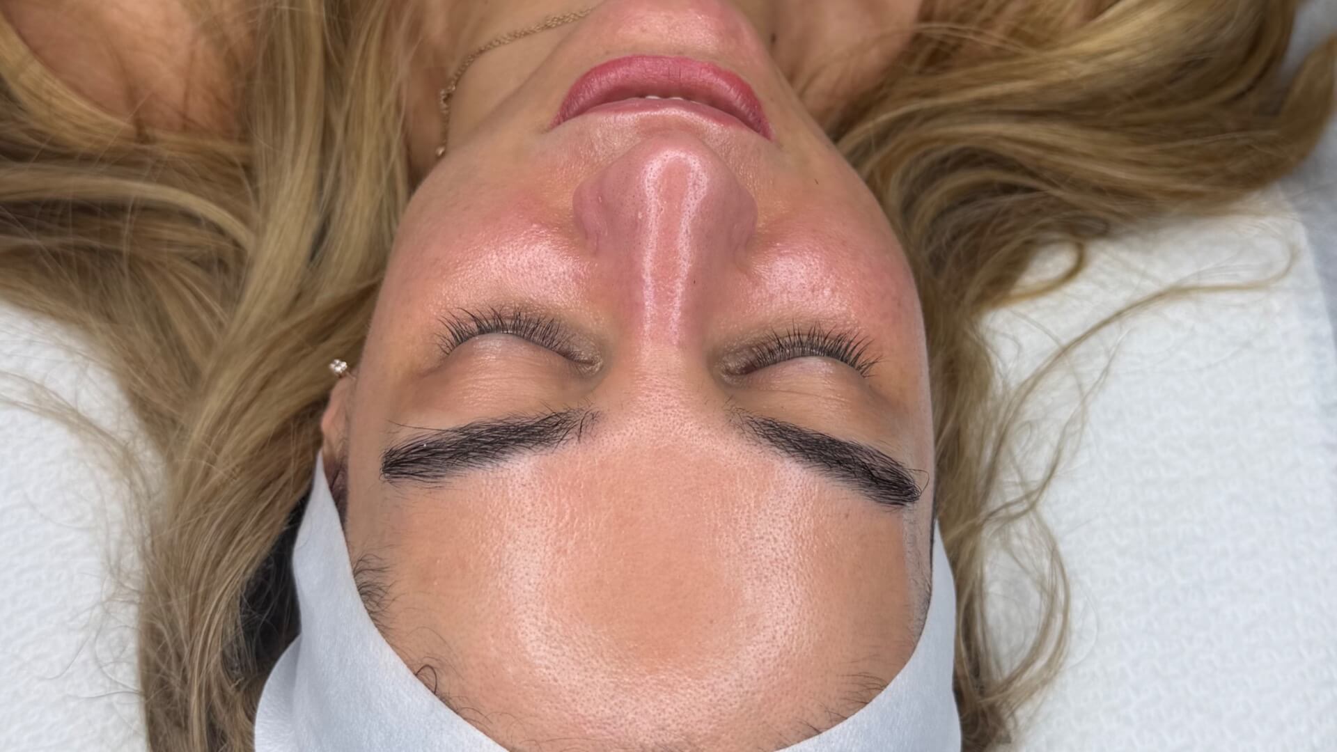  | Avigail Bason | Advanced skin care